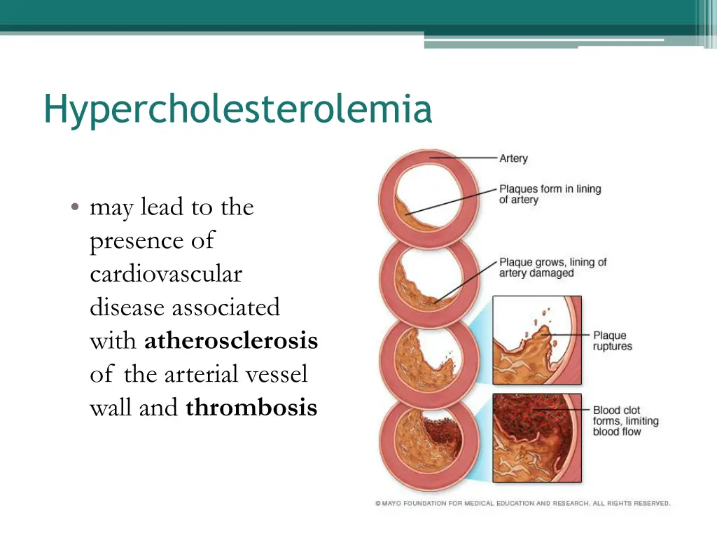 hypercholesterolemia 1