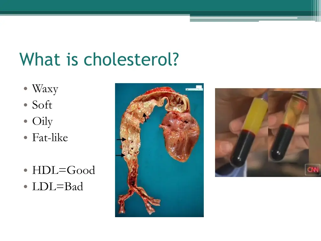 what is cholesterol