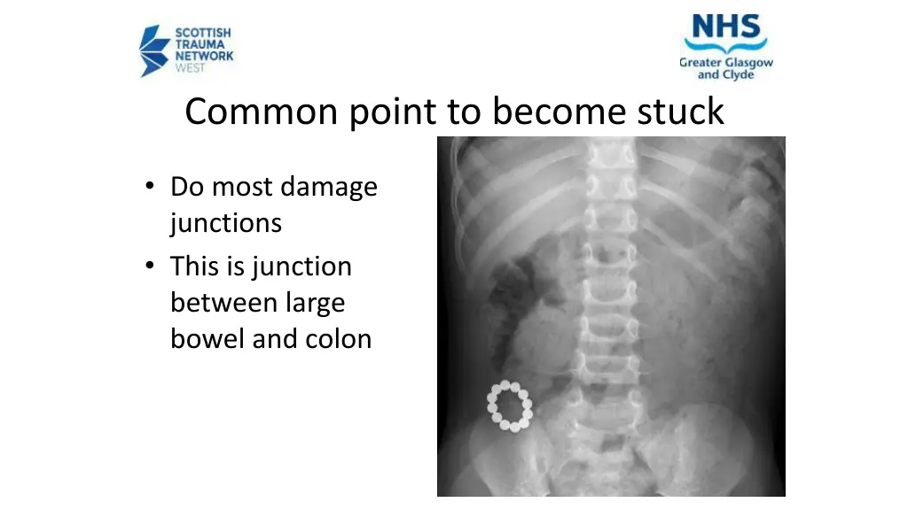 common point to become stuck