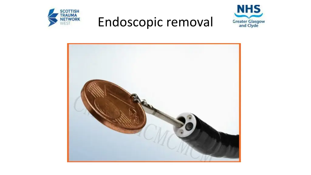 endoscopic removal