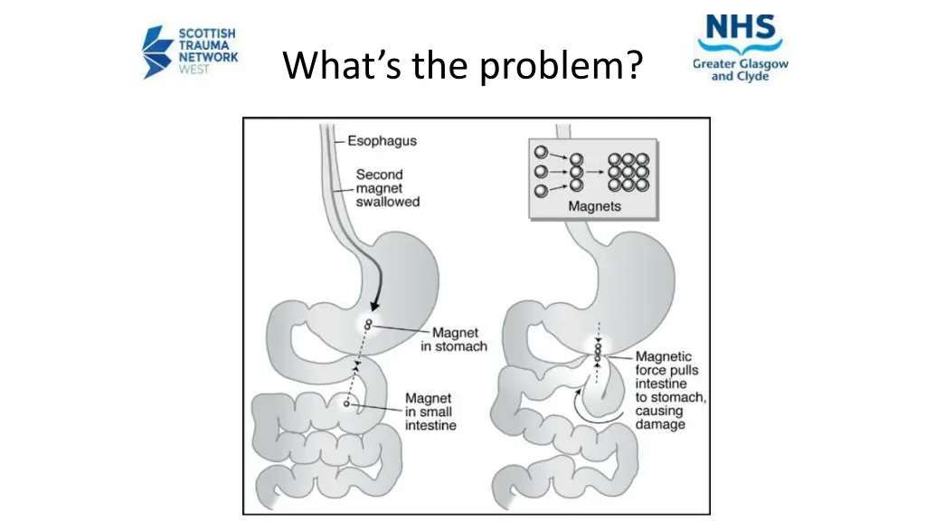 what s the problem