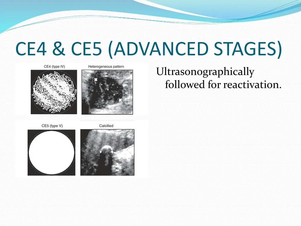 ce4 ce5 advanced stages