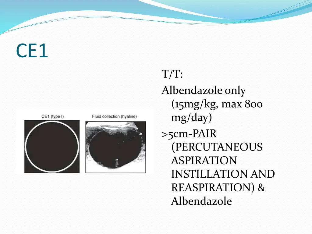 slide18