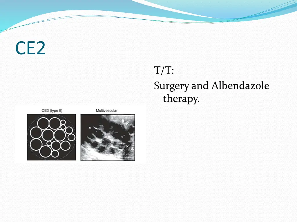 slide19