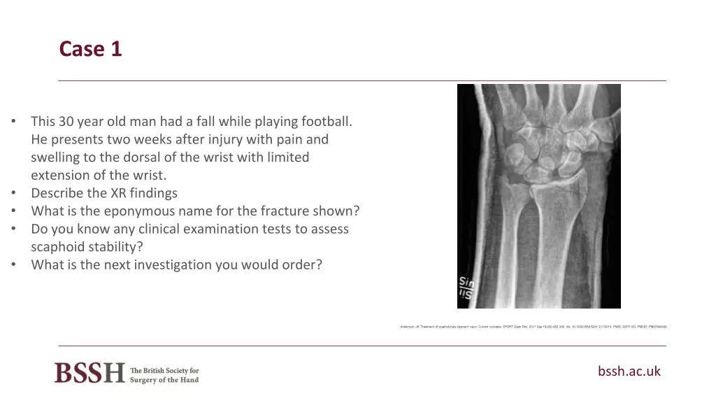 case 1