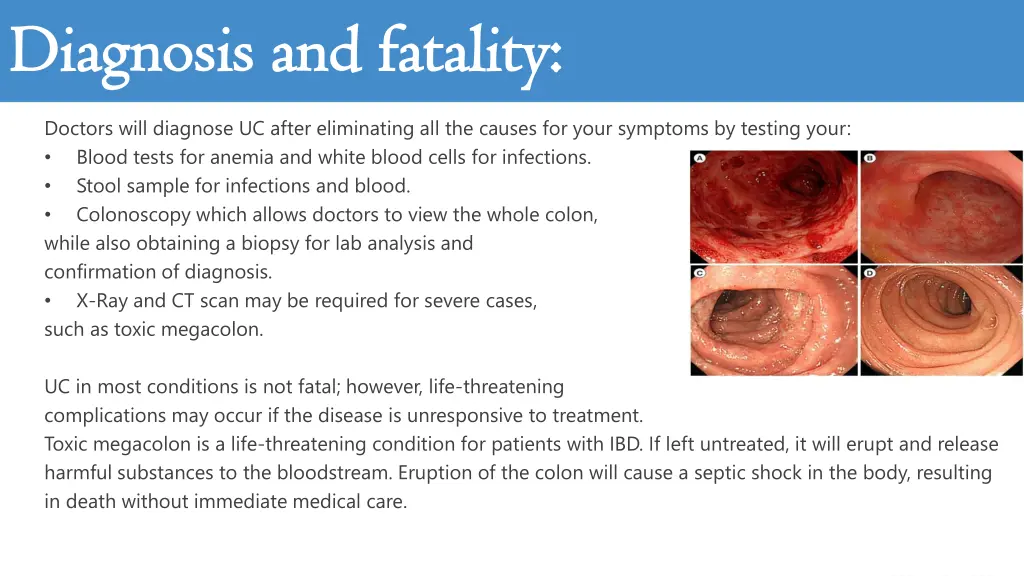 diagnosis and fatality diagnosis and fatality