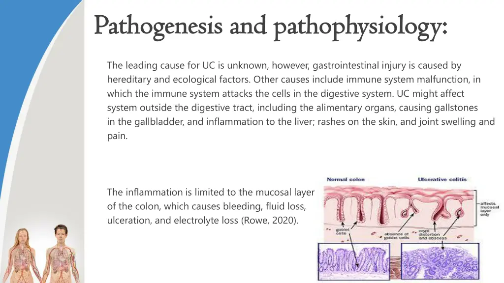 pathogenesis and pathophysiology pathogenesis
