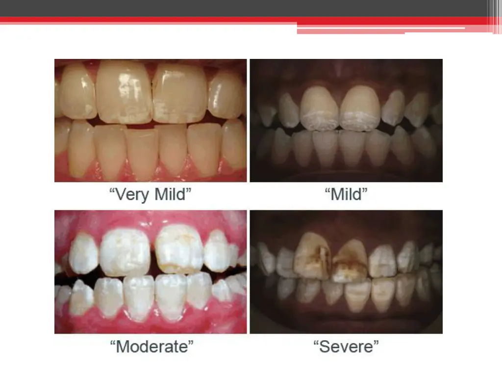 slide7
