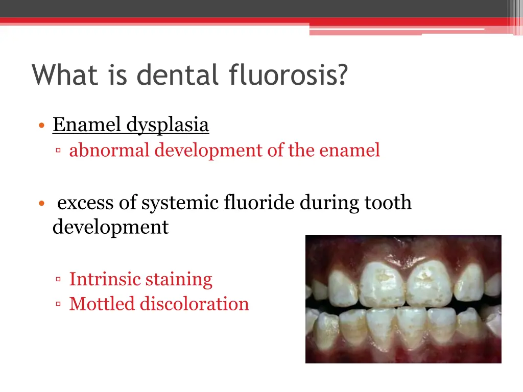 what is dental fluorosis
