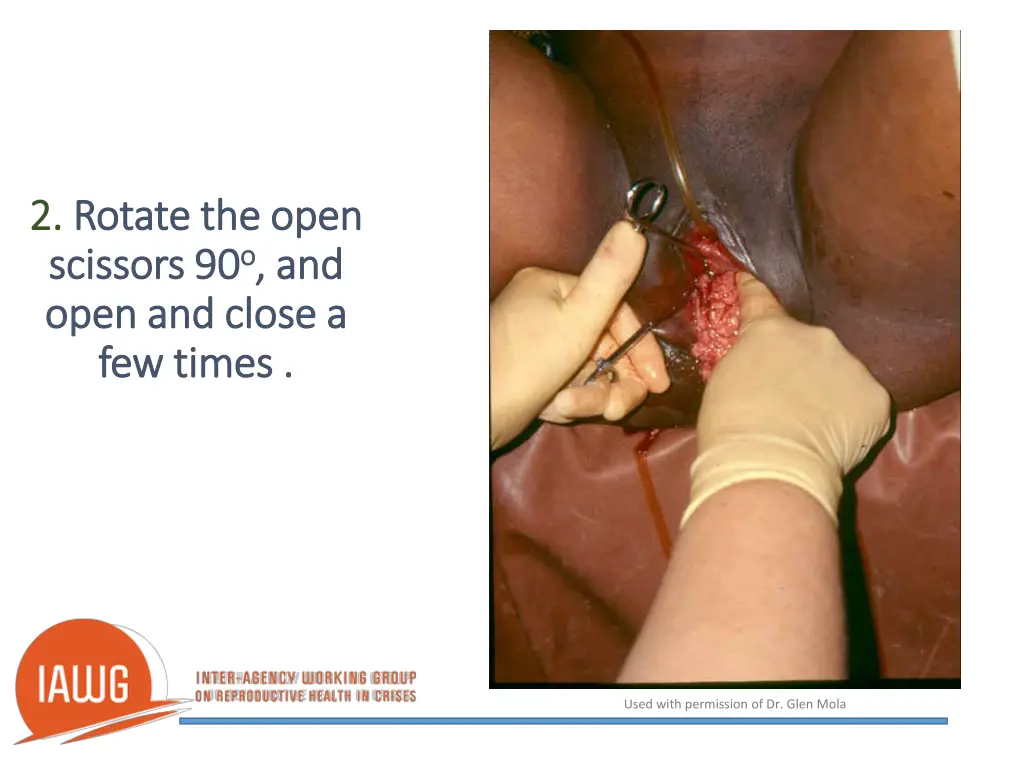 2 2 rotate the open rotate the open scissors
