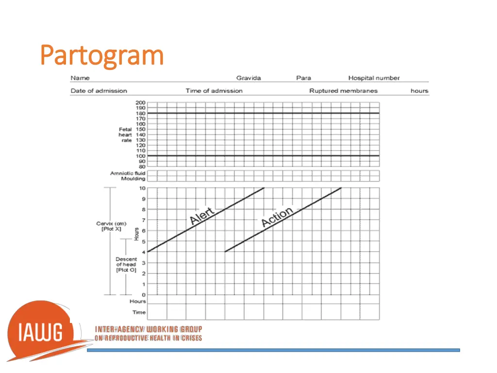 partogram partogram
