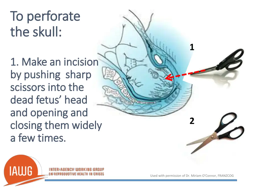 to perforate to perforate the skull the skull