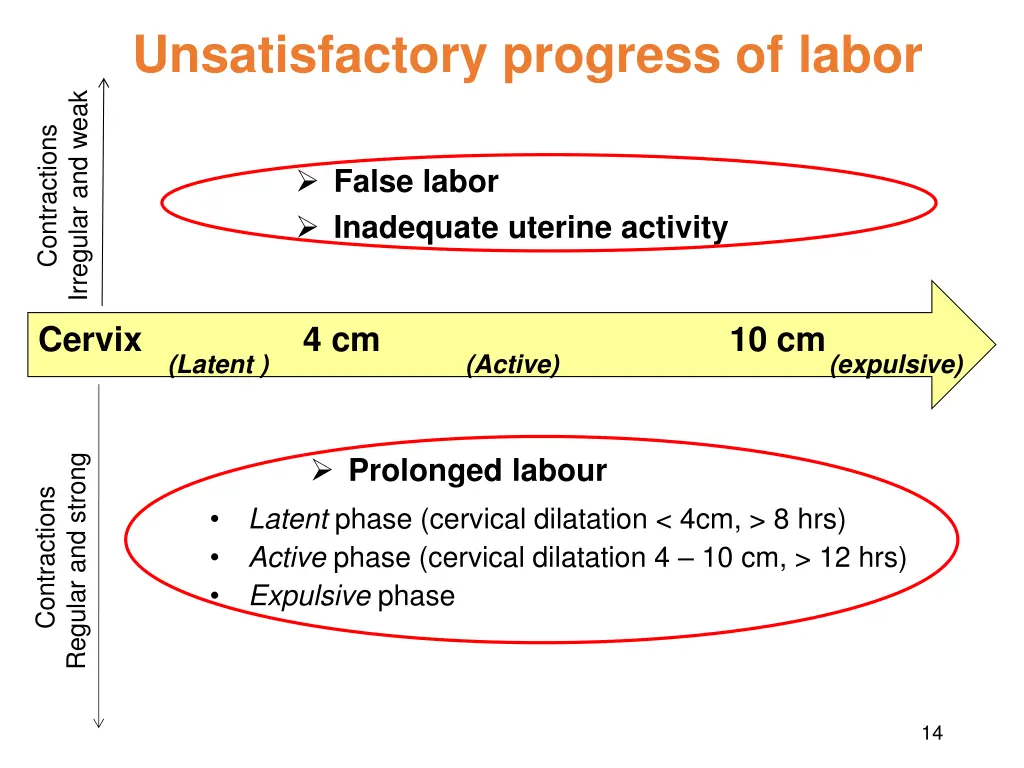 unsatisfactory progress of labor