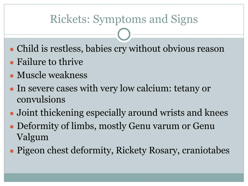 rickets symptoms and signs