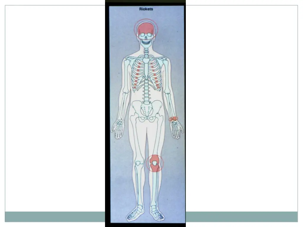 slide17