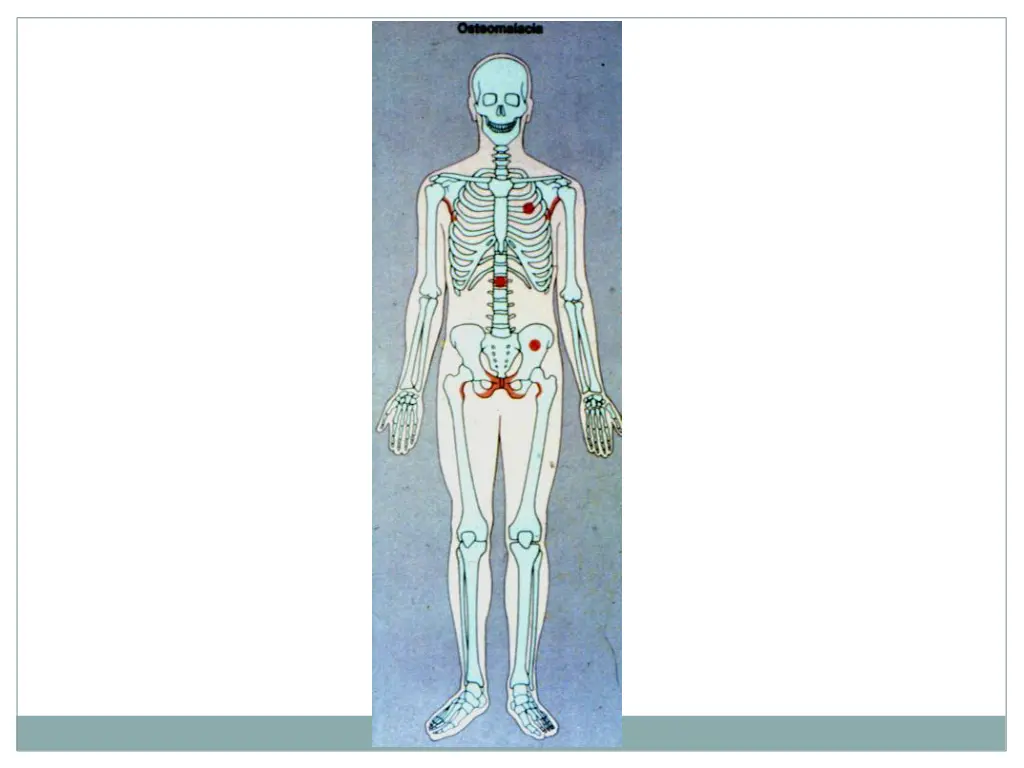 slide24