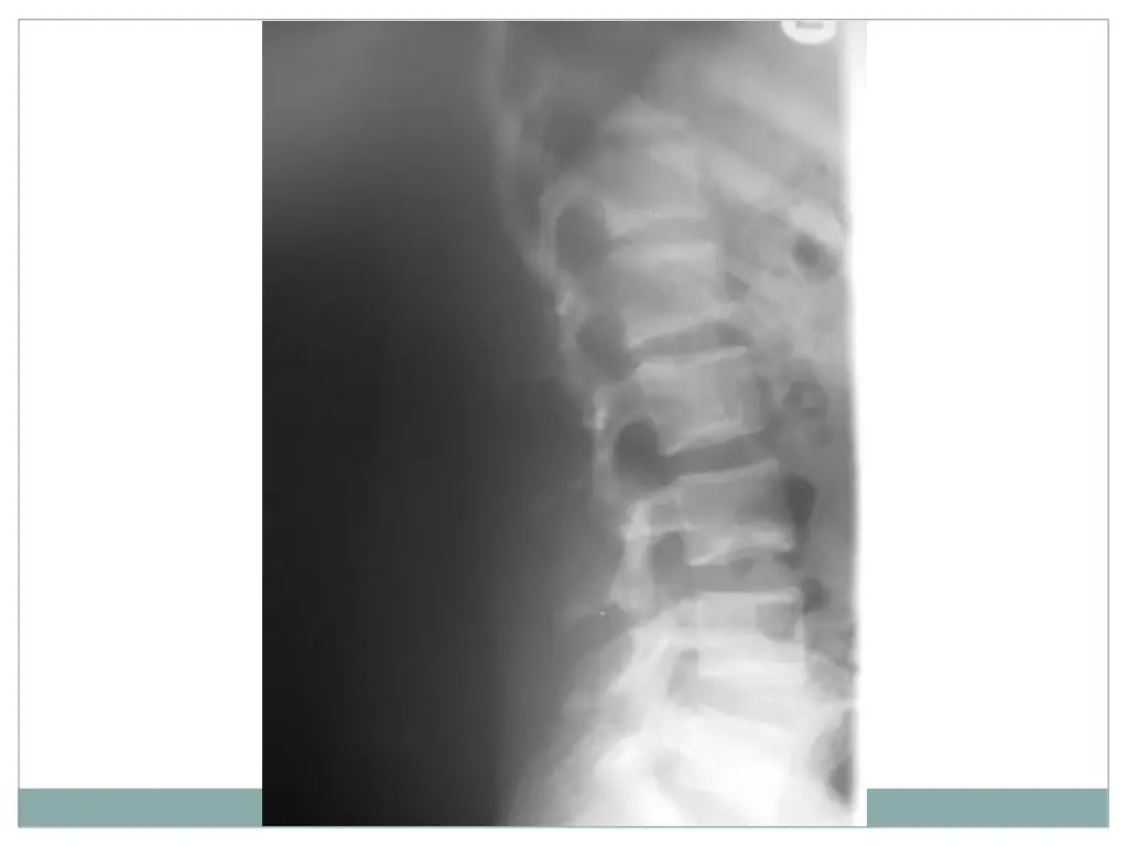 slide25