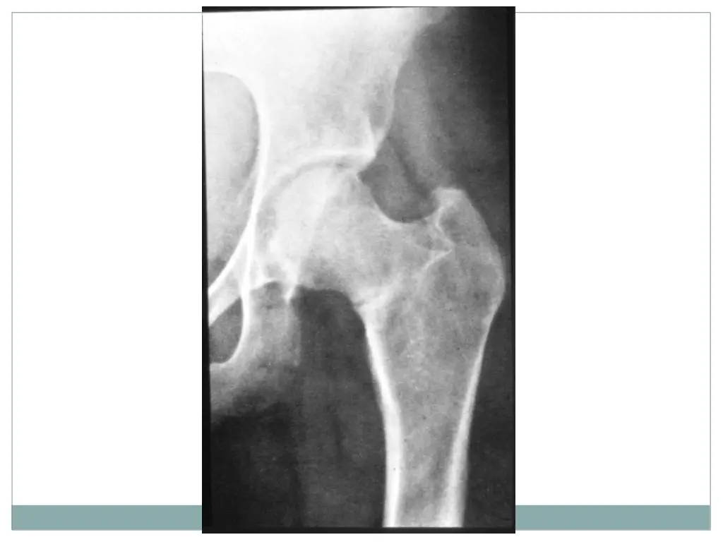 slide26