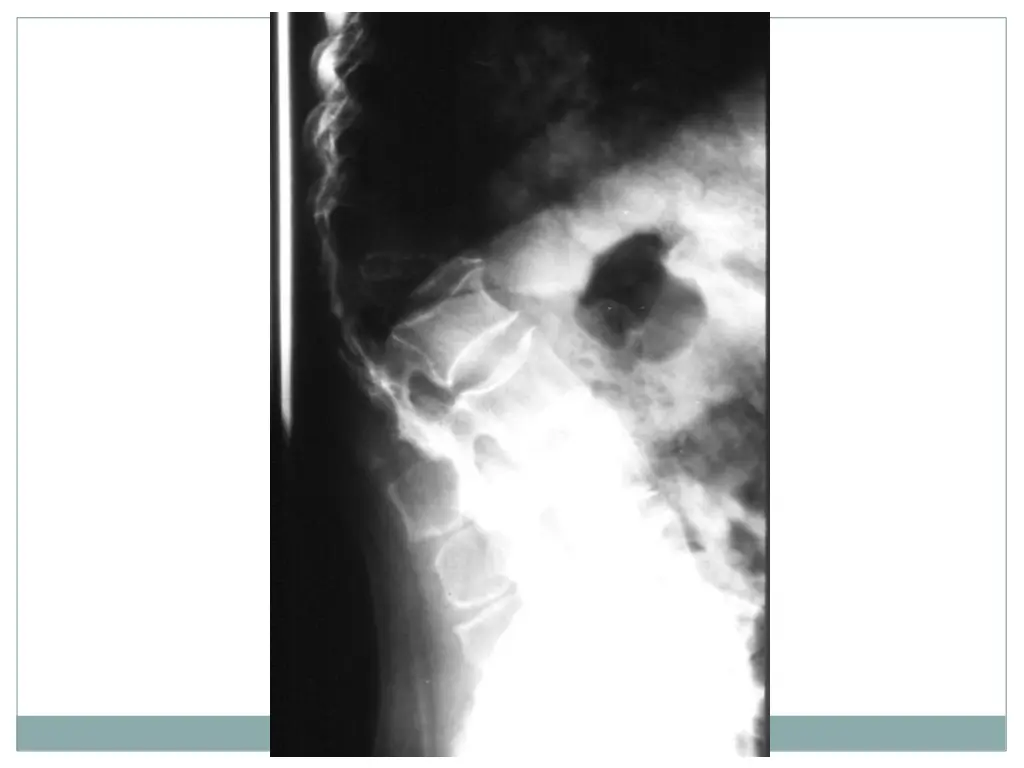slide27