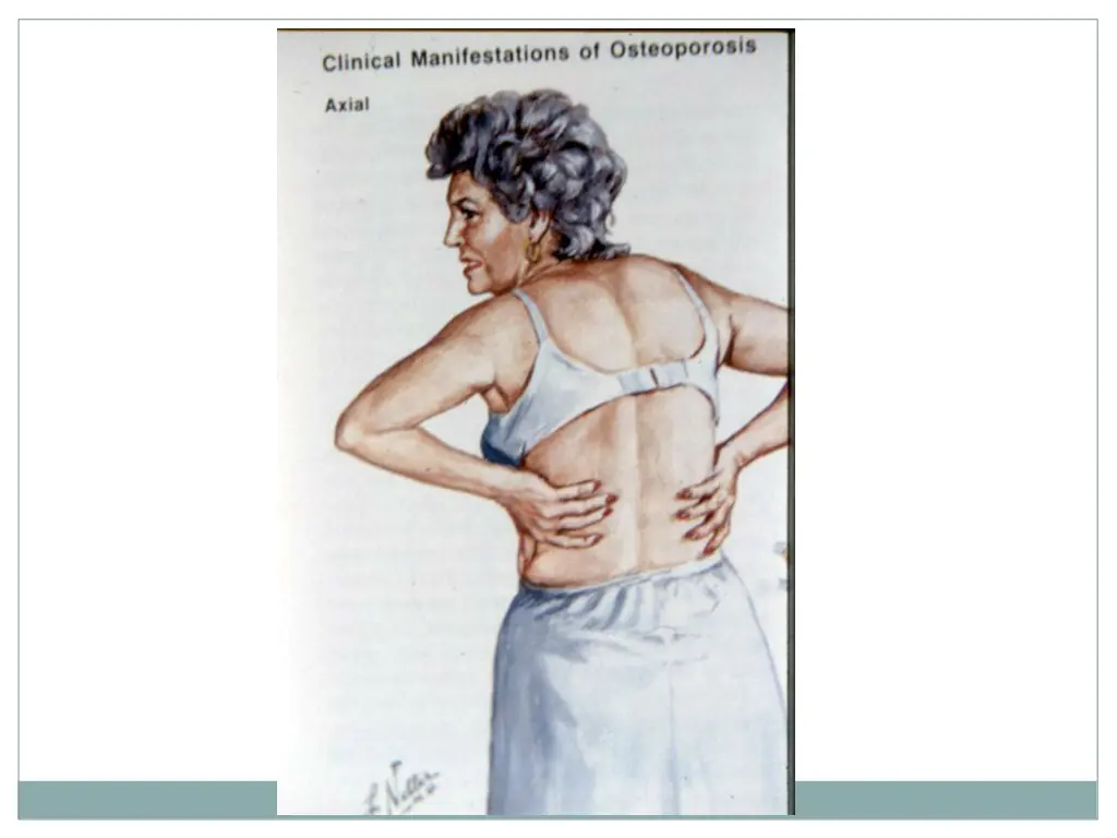 slide37