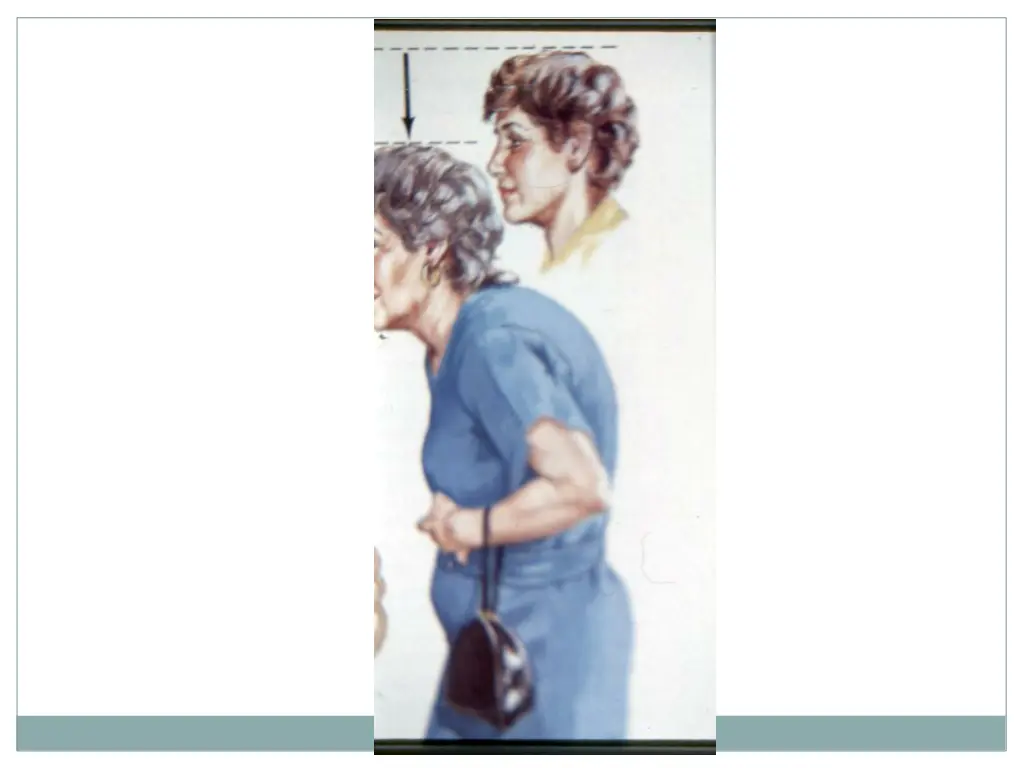 slide40