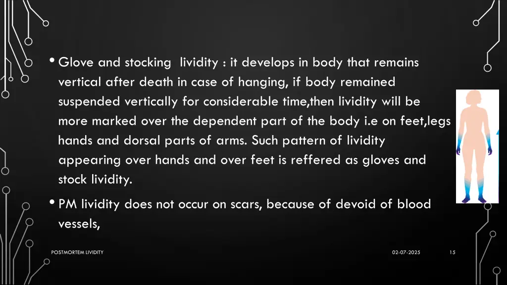 glove and stocking lividity it develops in body