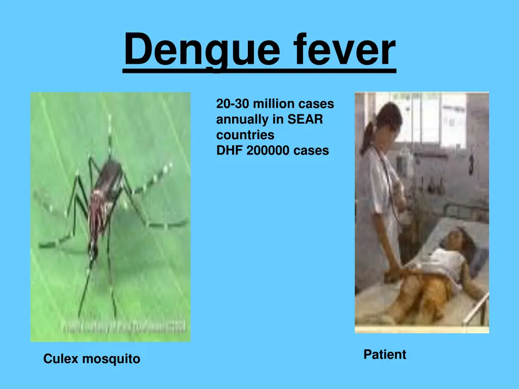 dengue fever
