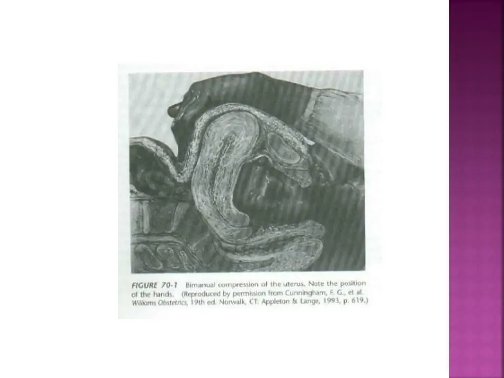 slide22