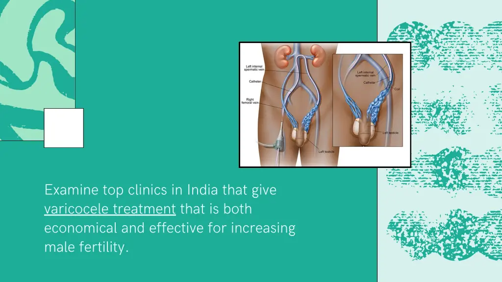 examine top clinics in india that give varicocele