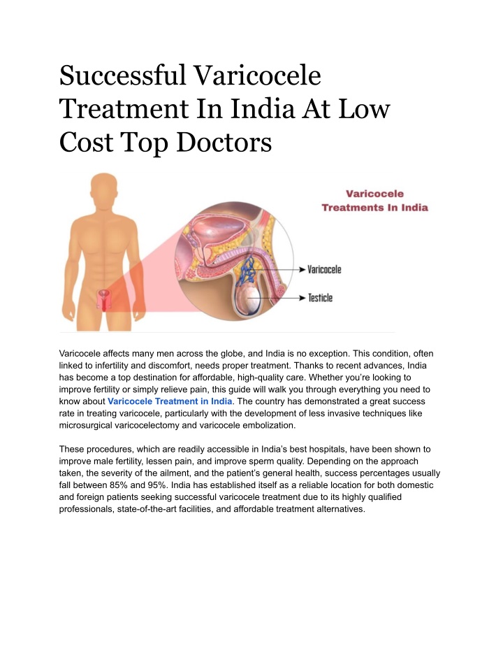 successful varicocele treatment in india