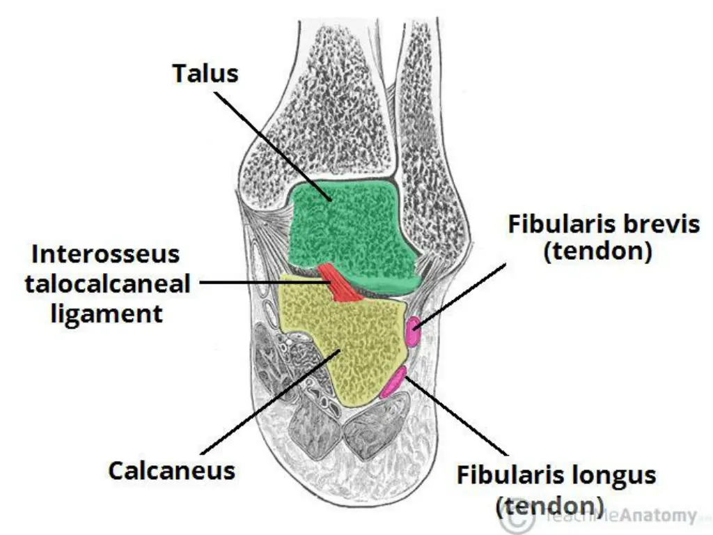 slide6