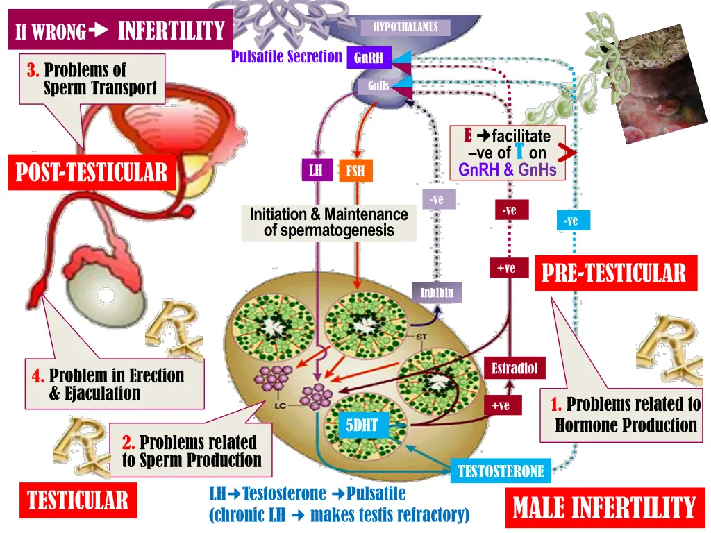 if wrong infertility