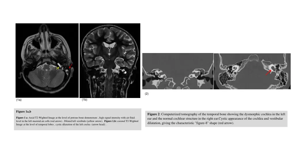slide3