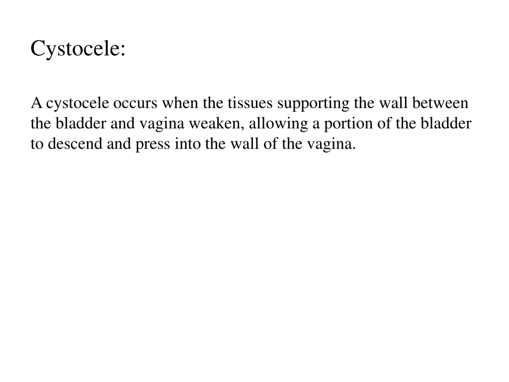 cystocele