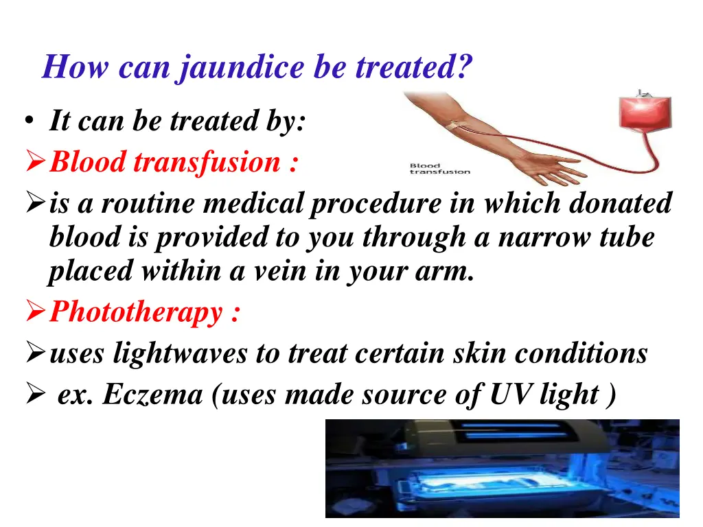 how can jaundice be treated it can be treated
