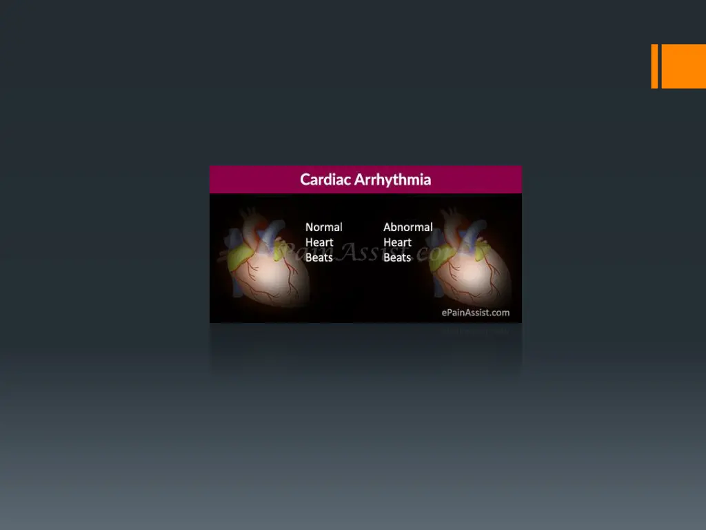slide14