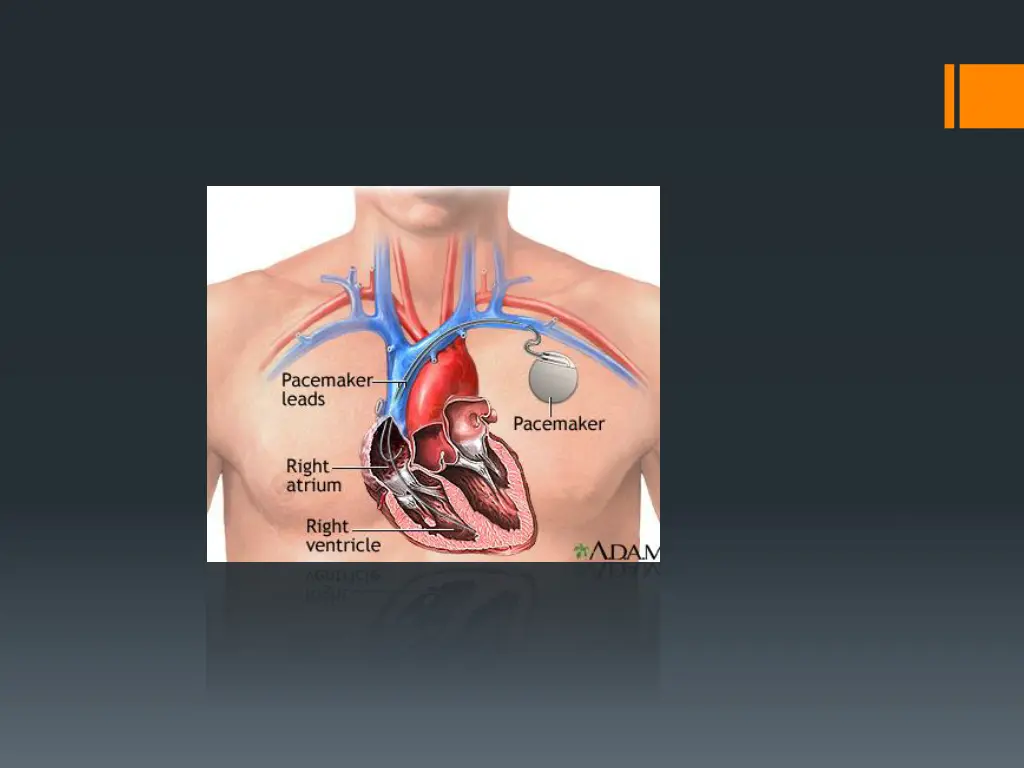 slide19