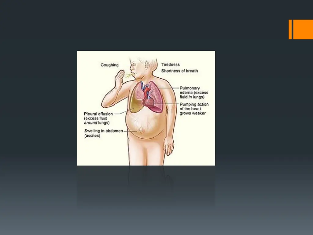 slide7