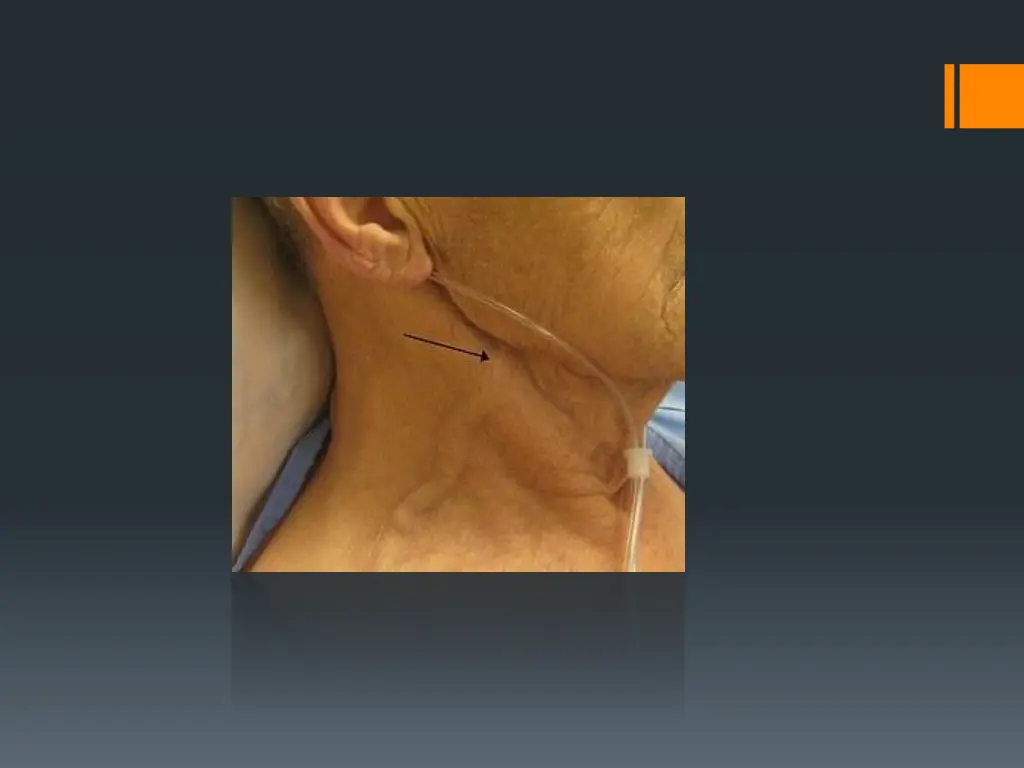 slide9