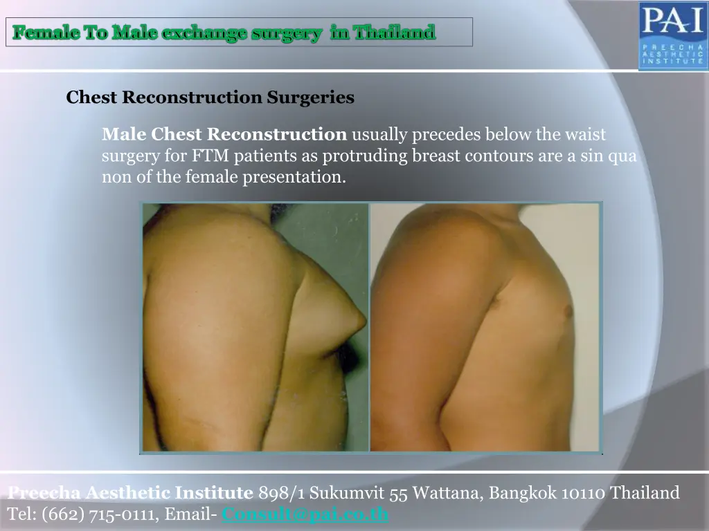 female to male exchange surgery in thailand 1