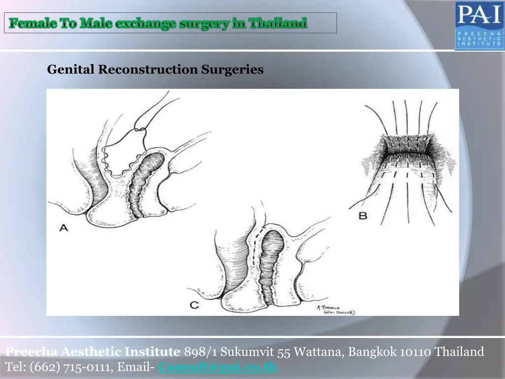female to male exchange surgery in thailand 3