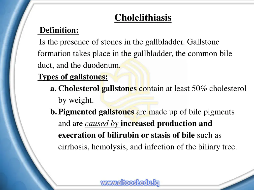 cholelithiasis