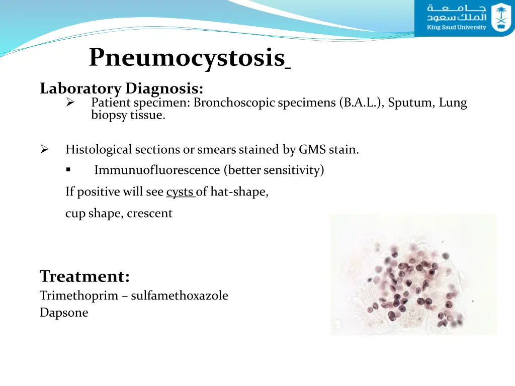 pneumocystosis