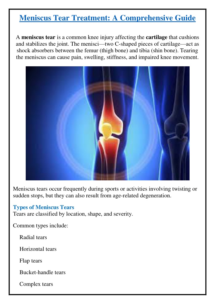 meniscus tear treatment a comprehensive guide