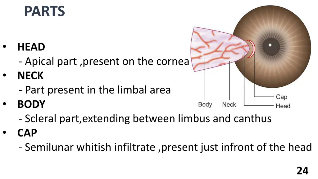 parts
