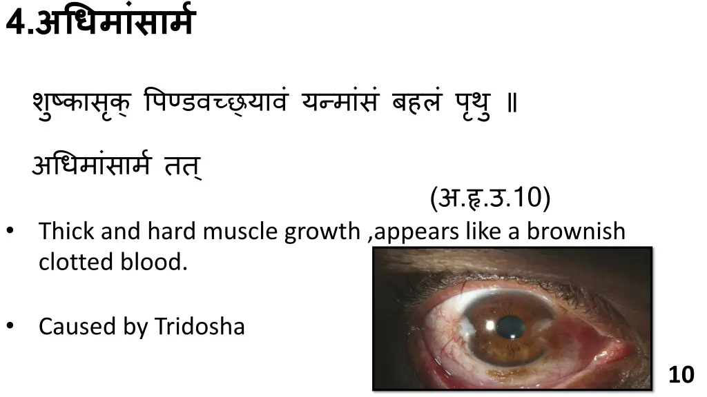 slide10
