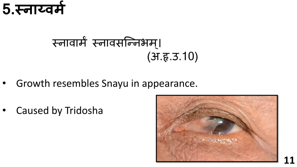 slide11