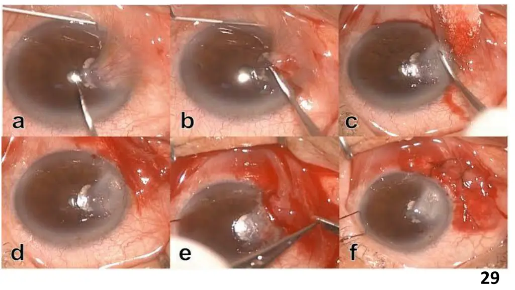 slide29