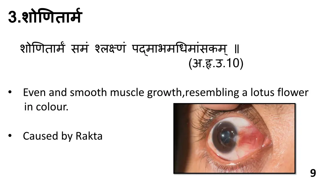 slide9