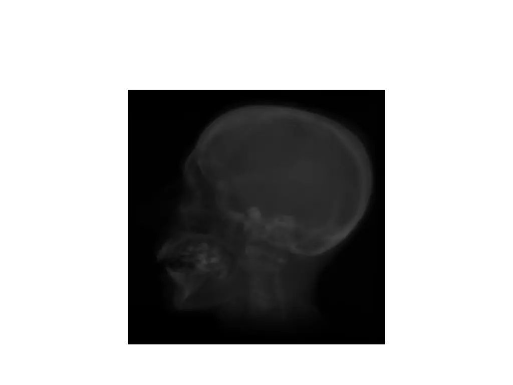 slide13